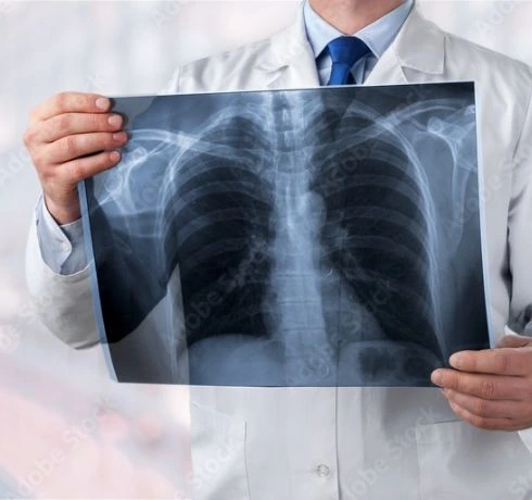 がんのイメージ図