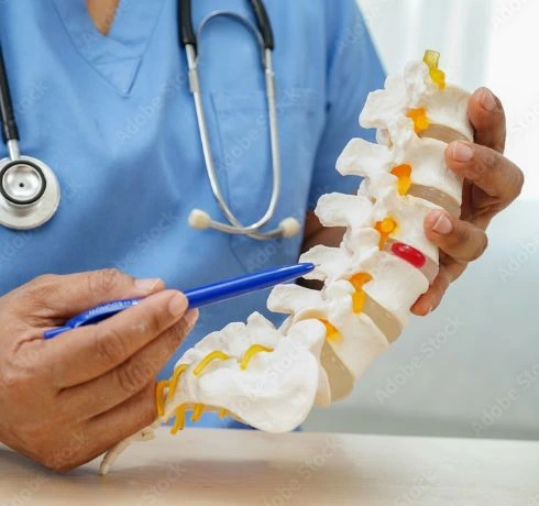 神経難病のイメージ図